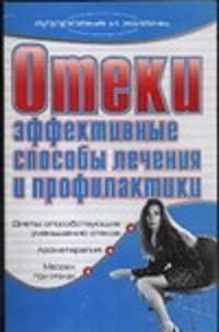  книга Отеки. Эффективные способы лечения и профилактики